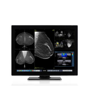 Coronis OneLook -MDMC-32133 Barco Mammografie Diagnostische monitor