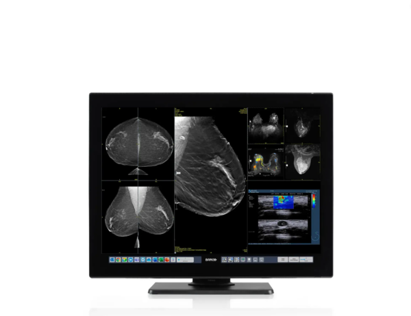 Coronis OneLook -MDMC-32133 Barco Mammografie Diagnostische monitor