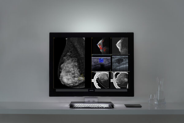 Coronis OneLook frontal op bureau Barco diagnostische monitor